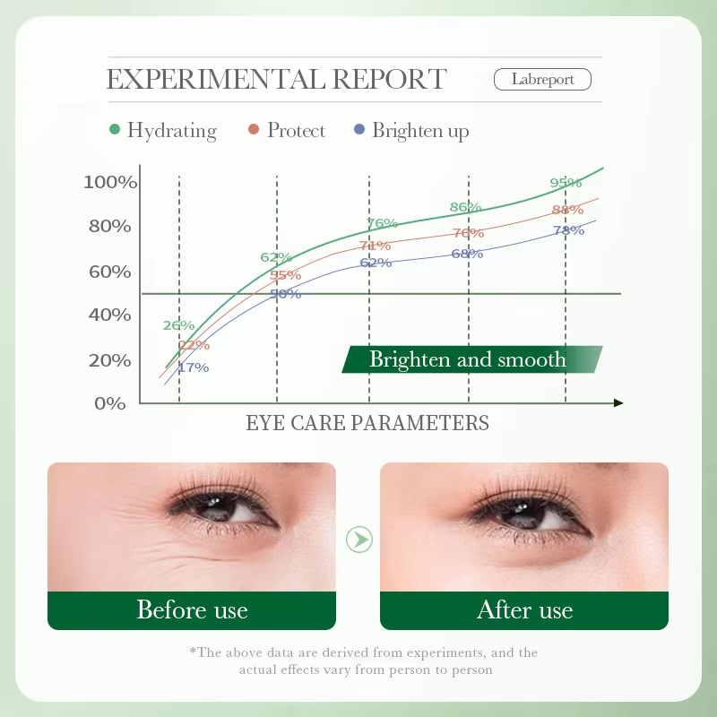 7 Days Tighten Smooth Wrinkles - Women Bags Under Eyes recension och pris